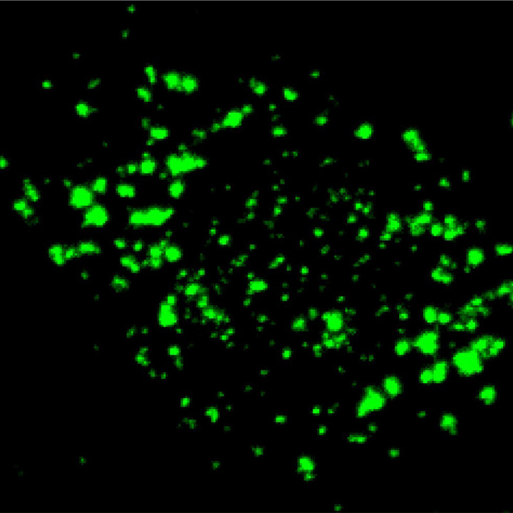 stress-granules-thumb.jpg