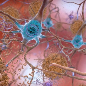 UTSW scientists eliminate key Alzheimer’s feature in animal model
