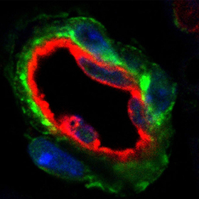 Two studies shed light on how, where body can add new fat cells