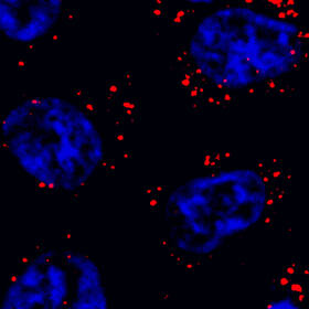 Not just a phase for RNAs