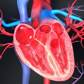 UTSW study finds mechanical hearts can regenerate some heart tissue