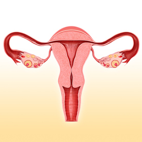 UT Southwestern review finds hysterectomy can be avoided for common gynecological condition
