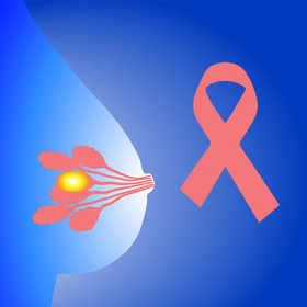 UT Southwestern researchers identify a regulator of breast cancer development