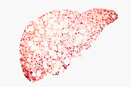 Researchers show that mutations in human livers can promote tissue regeneration
