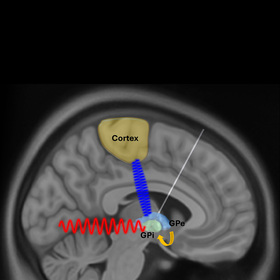 abnormal-brain-thumb.jpg