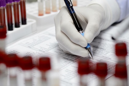Biomarker blood test could reveal high risk heart patients in need of treatment