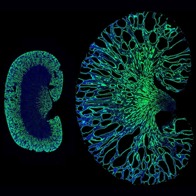 Chemical modification of RNA could play key role in polycystic kidney disease