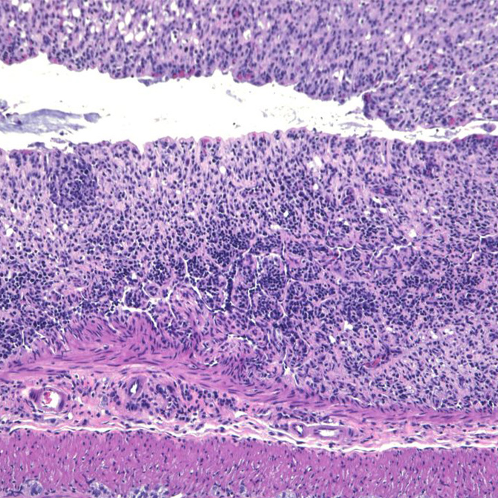 colon-tissue-thumb.jpg