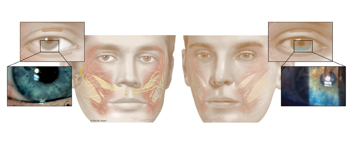 Diagrams of eyes and facial muscles