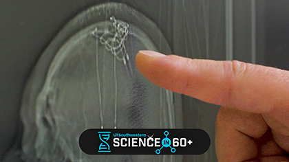 Finger pointing at scan.