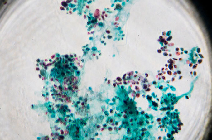 Yeast (eukaryotic) cells in a petri