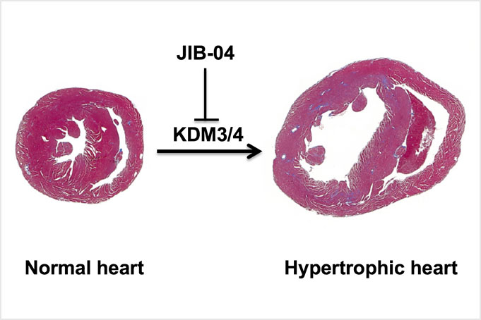 Normal heart vs enlarged heart