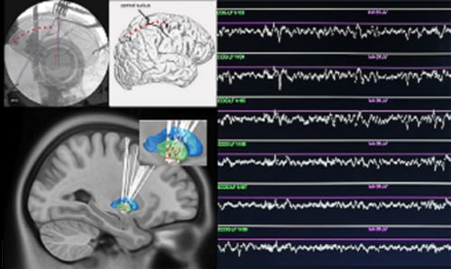 Scan of brain showing line readings
