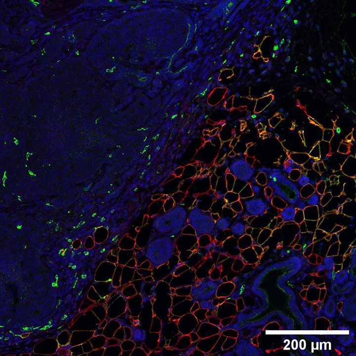 Fat cells (shown in red) on blue and green background