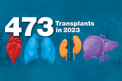 473 Transplants performed in 2023