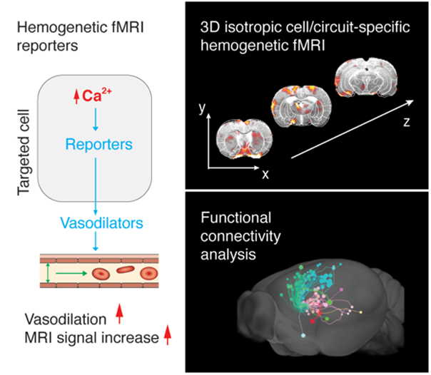 scan of functional brain metworks on MRI