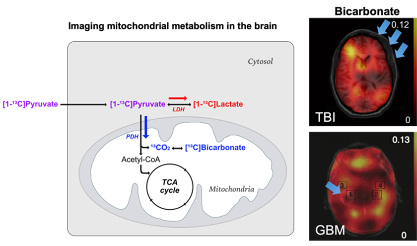 in vivo imaging of cerebral metabolism