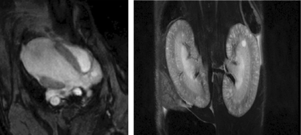 contrast MR image of renal arteries