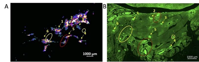 Zinc ions from tissues scanned using MR contrast agents