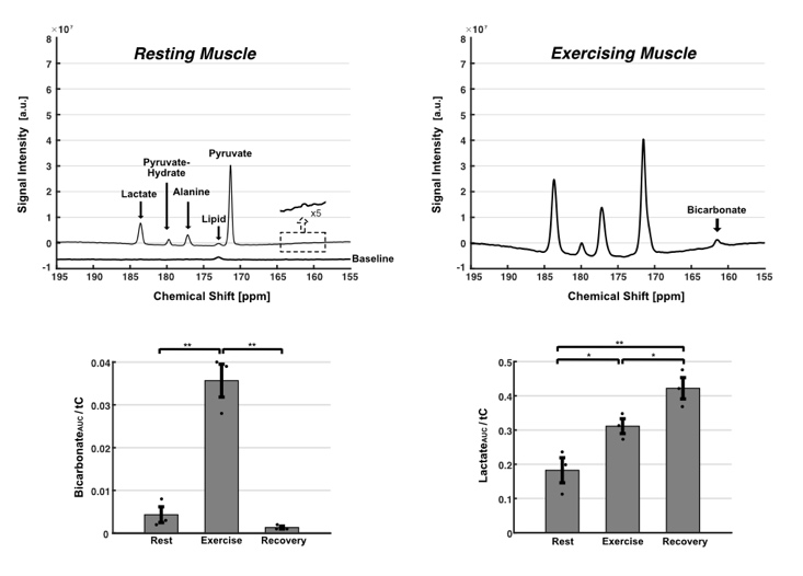 MRI scan of pyruvate oxidation in skeletal muscles