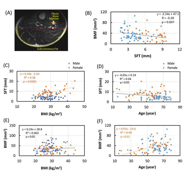 whole body MRI studies skeletal muscles