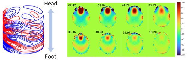 AIRC ultrahigh MRI B0 shimming tool helps improve scans