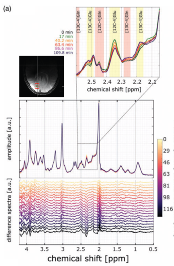 13C carbon magnetic resonance spectroscopy at AIRC