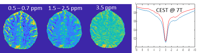 chemical exchange saturation transfer imaging scan at AIRC