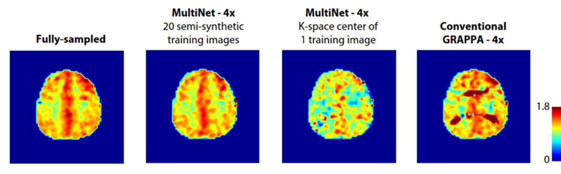 AIRC develops single voxel and spectroscopic imaging reconstruction and processing methods
