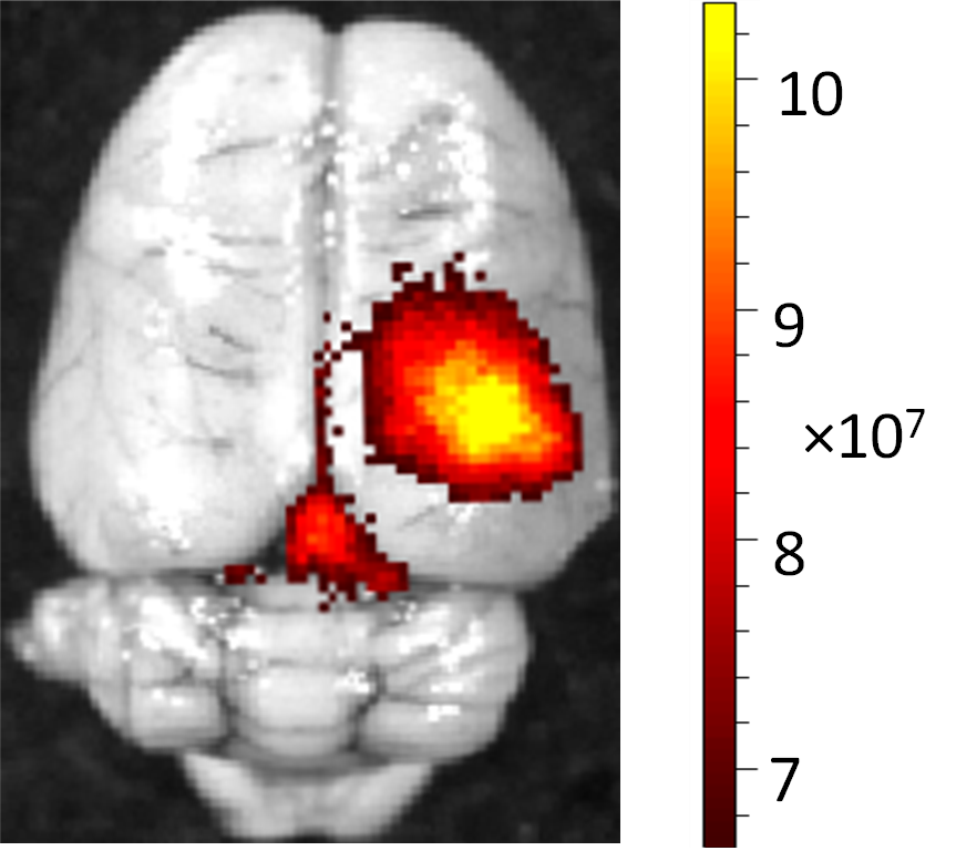 AIRC image of high-frequency focused ultrasound