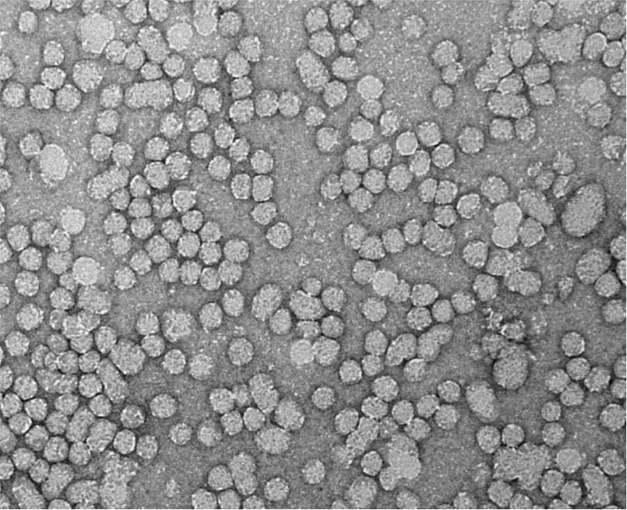 AIRC research image of LDL impacts cancer cells