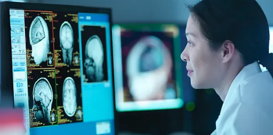 Doctor looks at brain scans on a computer screen.