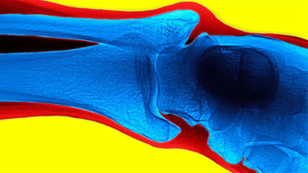 diagnostic imaging of a knee joint