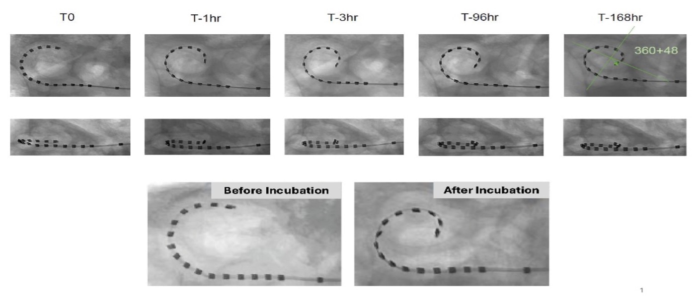 Time Lapse Fluoroscopic images of SMP cochlear implant