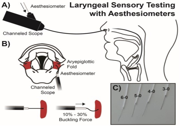 Sensory Mechanisms in Primary Muscle Tension Dysphonia: Laryngeal Sensory Testing With Aesthesiometers