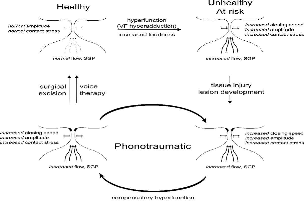 Phonotraumatic vocal hyperfunction framework