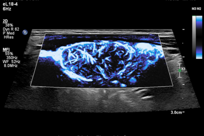 David-Fetzer-body2-ultrasound