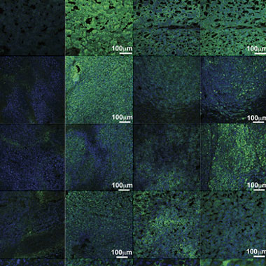 Blue and green cell images in a grid with 100 micro-m marked off