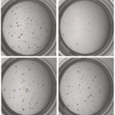 Four white cells with varying amounts of dark spots on them