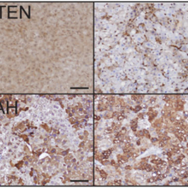 Four panels of brown and tan cell images
