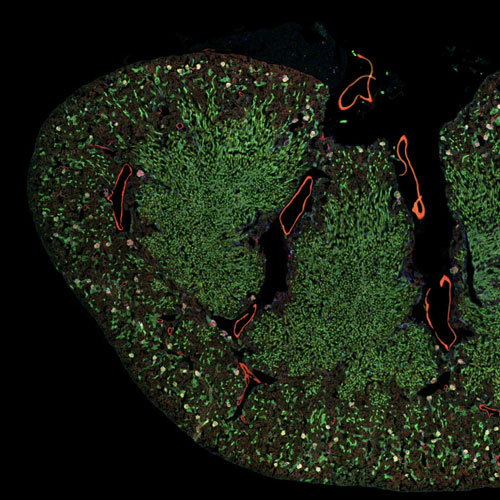 Microscopic green image with red lines