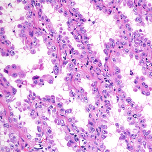 Microscopic image of pink stained tissue
