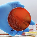 hand with blue gloves holding red petri dish