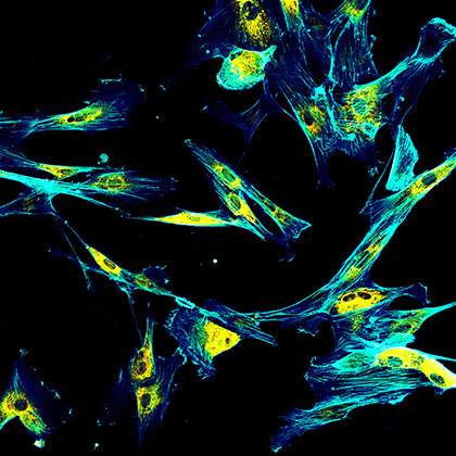 Immunofluorescence confocal imaging of fibroblasts with endoplasmic reticulum in yellow and cytoskeleton in cyan