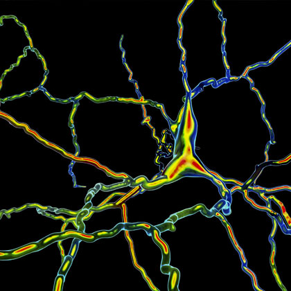 3D illustration of a dopaminergic neuron. Degeneration of this brain cells is responsible for development of Parkinson's disease. 3D illustration of a dopaminergic neuron
