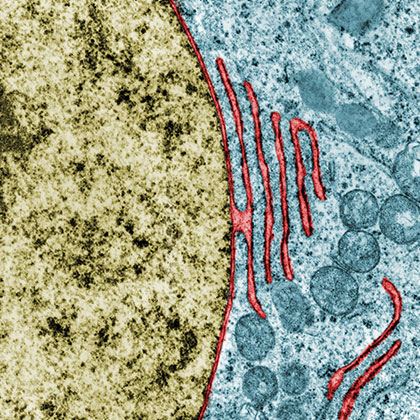 Lab image of nuclear envelope