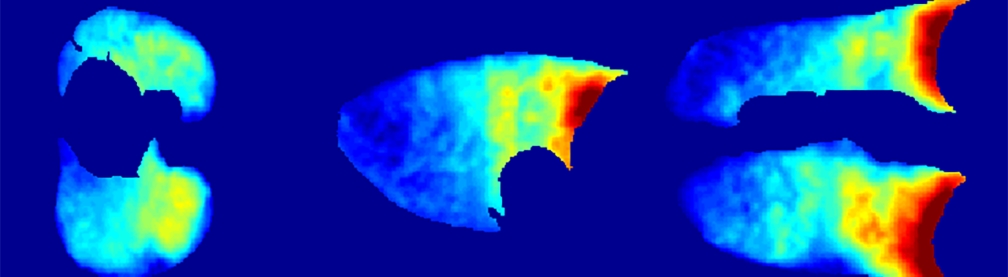 medical physics image