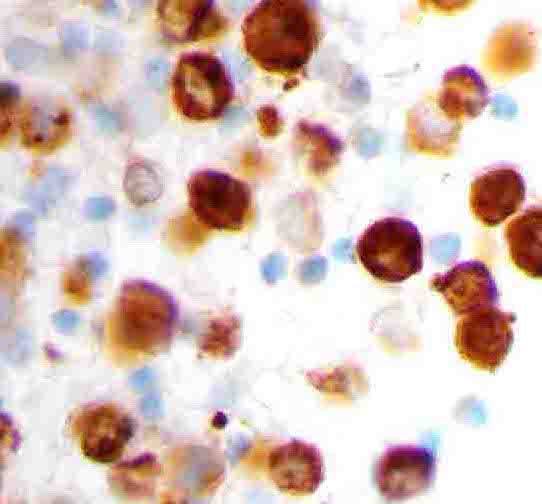 Immunohistochemical stain