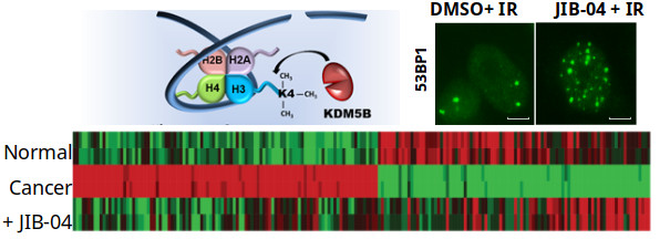 Top left: A diagram of histone interaction with the demethylase KDM5B. The histones are shown as four colored lobes inside a loop of a DNA helix, while KDM5B is a red ovoid outside the loop. An arrow goes from the ovoid to a methyl group on one of the histones.
Top right: Two images of cells stained with green fluorescent protein. One labeled DMSO+IR is sparsely stained. One labeled JIB-04 + IR is more heavily stained.
Bottom: Three long, thin rows of pixelated black, red, and green rectangles. The three rows are labeled Normal, Cancer, and +JIB-04