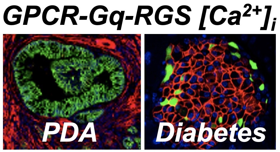 Two images of cells, under the header GPCR-Gq-RGS [ca2+]. The left cell has a thick inner ring stained green and is labeled PDA. The right cell has a diffuse red-stained interior and is labeled Diabetes.